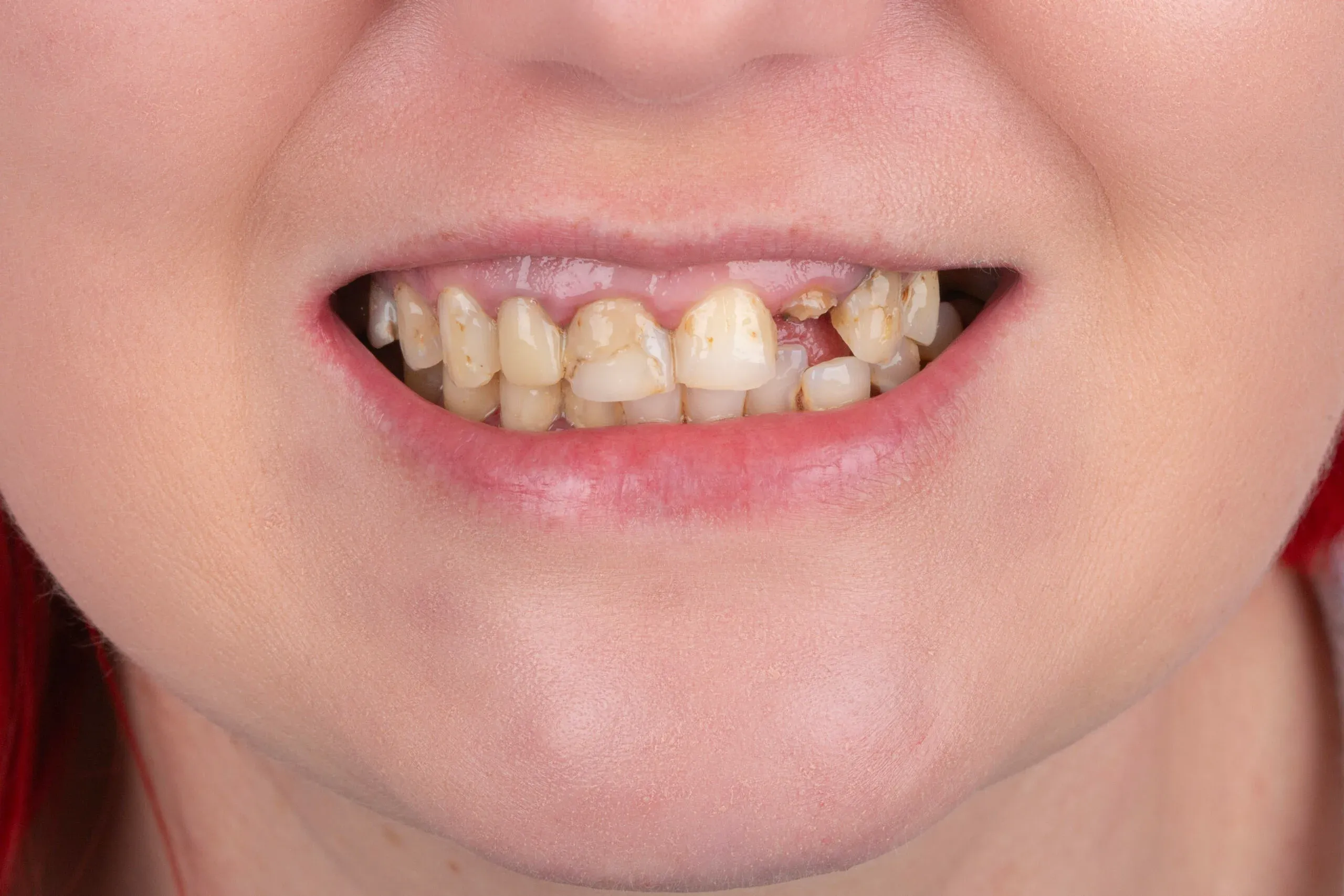 imgi_12_2v9a0913-copy-scaled-1