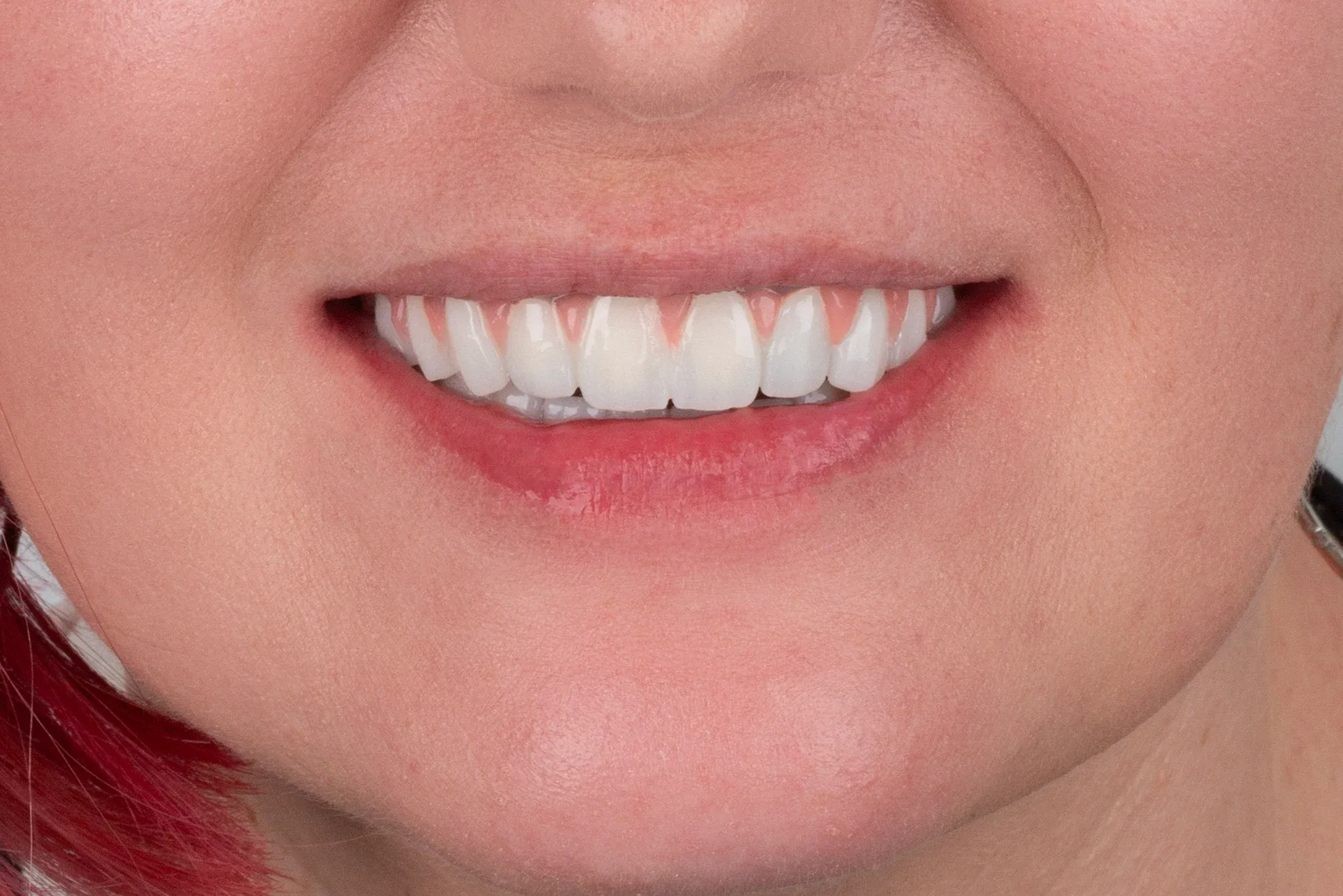 imgi_13_2v9a0668-copy