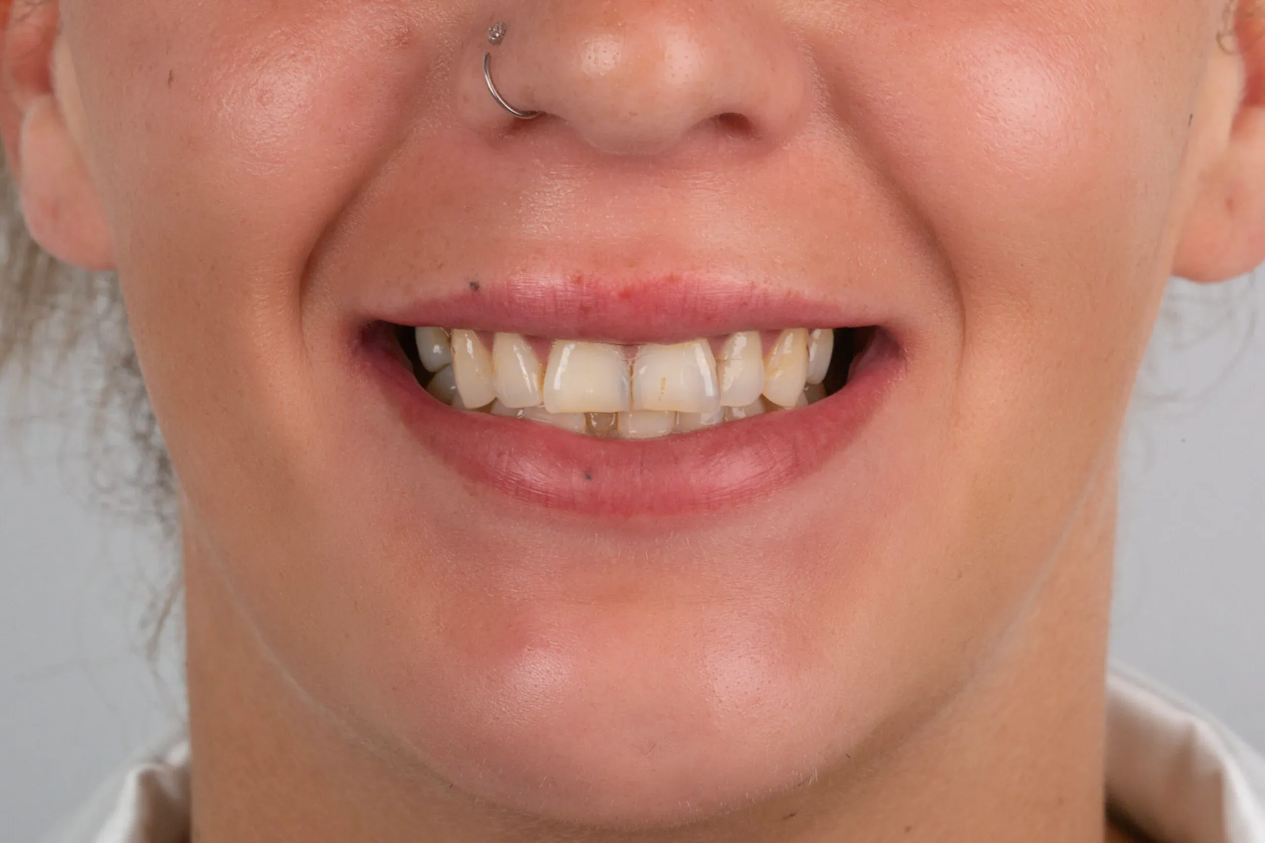 imgi_2_2v9a6861-copy-scaled-1