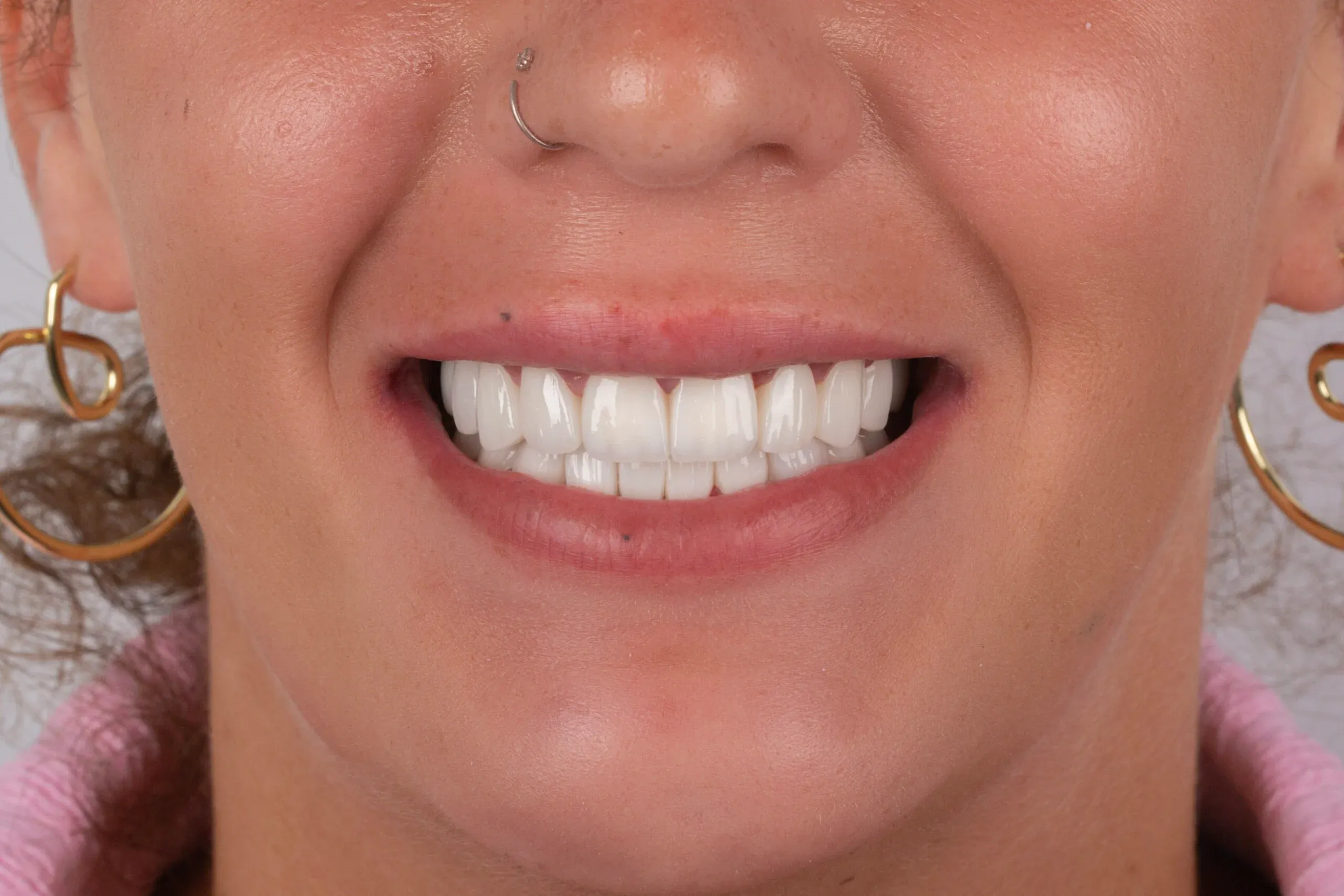 imgi_3_2v9a0143-copy-scaled-1