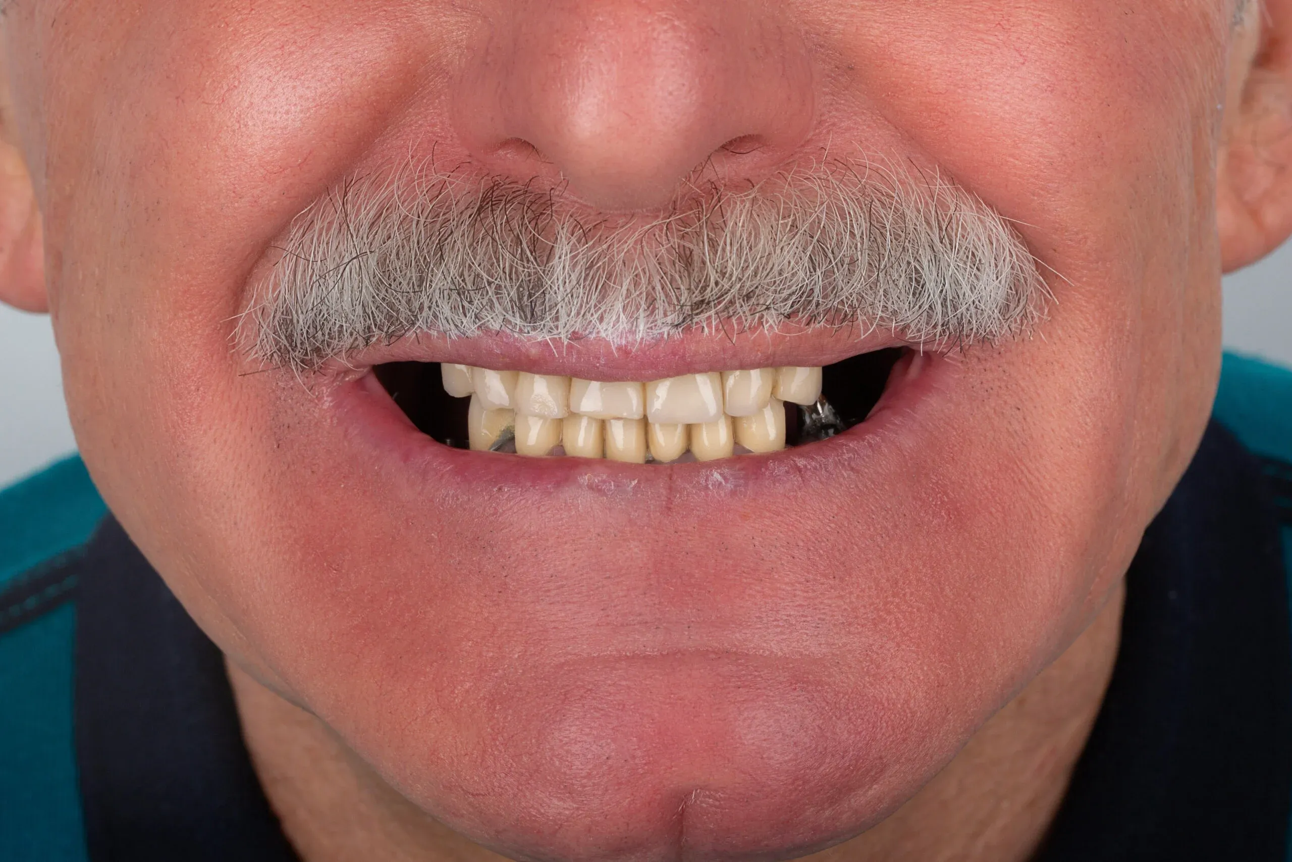 imgi_6_2v9a2422-copy-scaled-1