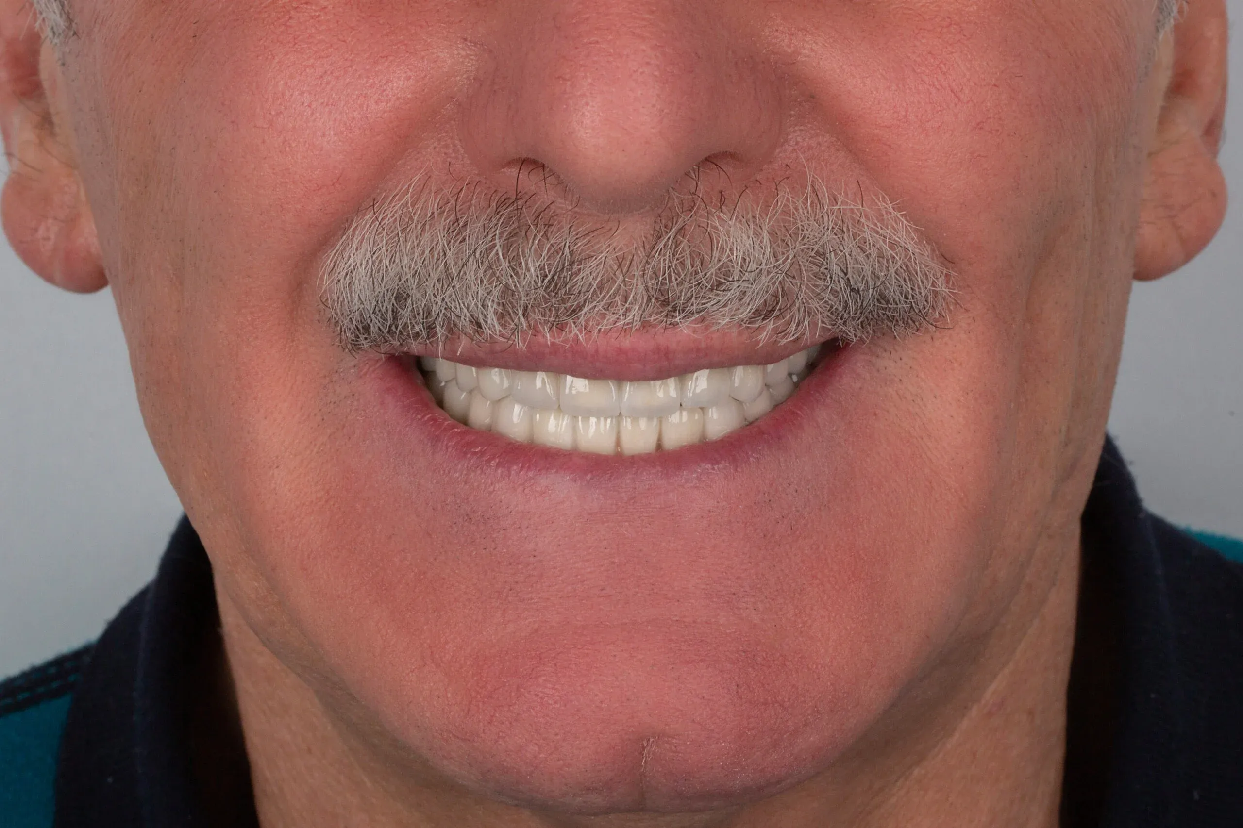 imgi_7_2v9a6799-copy-scaled-1